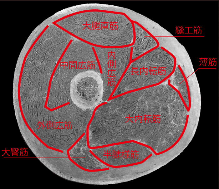 画像に alt 属性が指定されていません。ファイル名: 大腿断面.gif