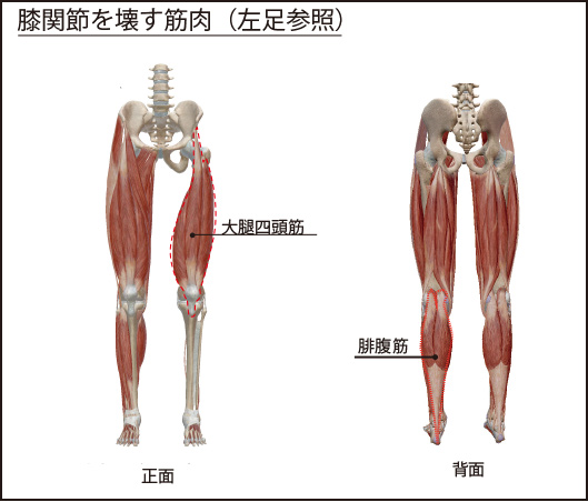 図１１：膝関節を壊す筋肉３