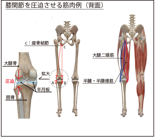 図９：膝関節を壊す筋肉（背面）