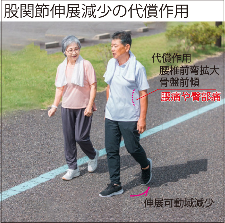 股関節伸展減少の代償作用による腰痛や臀部痛